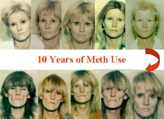crystal meths vorher nachher bild
