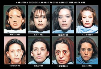 crystal meths vorher nachher bild gesicht